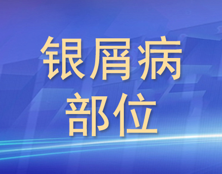 银屑病部位